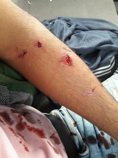 مصدومیت یک جوان الموتی در اثر حمله پلنگ