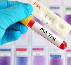 انجام غربالگری سه سرطان شایع در مشهد