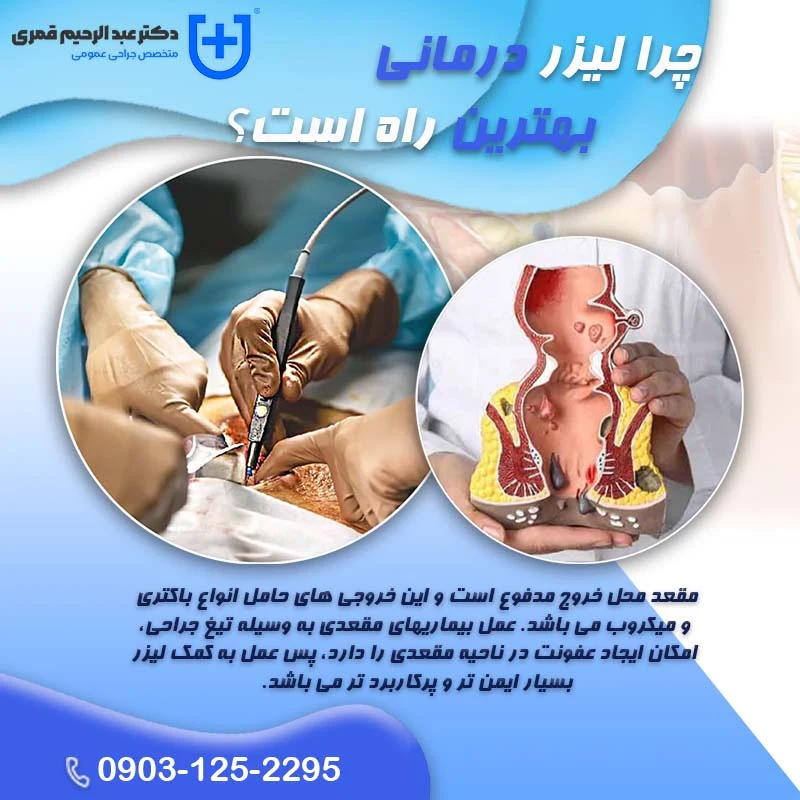 درمان شقاق برای کارمندان در امیرآباد تهران درمان شقاق برای کارمندان در امیرآباد تهران